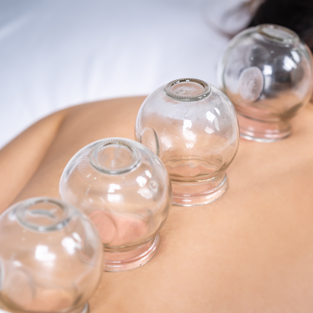 TCM Fire Cupping Certification